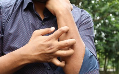 Biothérapies et intolérances ou allergies